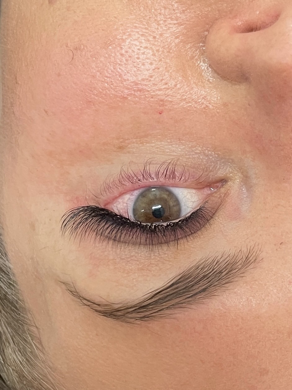 Cosmetic tattoo